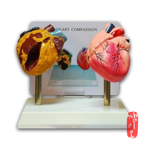[보건쌤이오] 금연교육 흡연 비교 인체 심장 모형