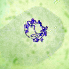 [과학쌤이오] 유전발생 초파리 침샘염색체 슬라이드
