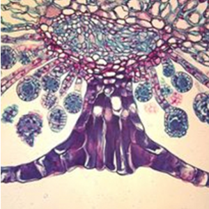 [과학쌤이오] 고사리 포자낭 포막 횡단 슬라이드 표본